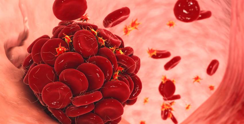 Підступні тромбоцити: чому вони ростуть і як повернути їх у норму
