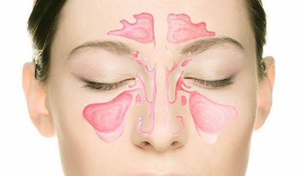 Чисте дихання без ліків - як очистити гайморові пазухи самостійно