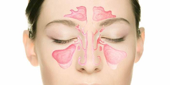Чисте дихання без ліків - як очистити гайморові пазухи самостійно