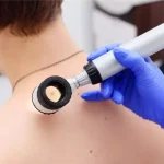 Шкіра як дзеркало здоров'я - що розповість дерматологія