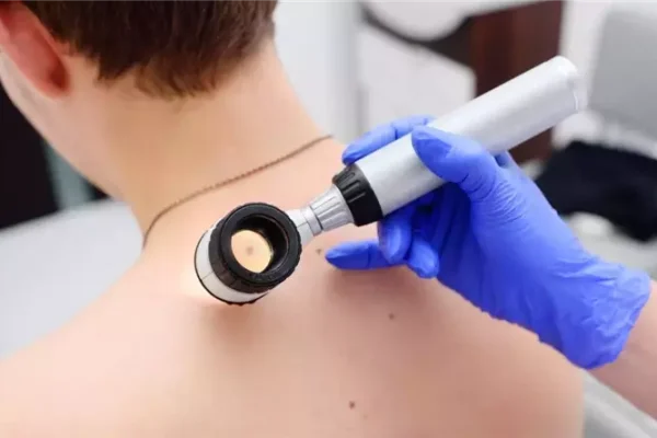 Шкіра як дзеркало здоров'я - що розповість дерматологія