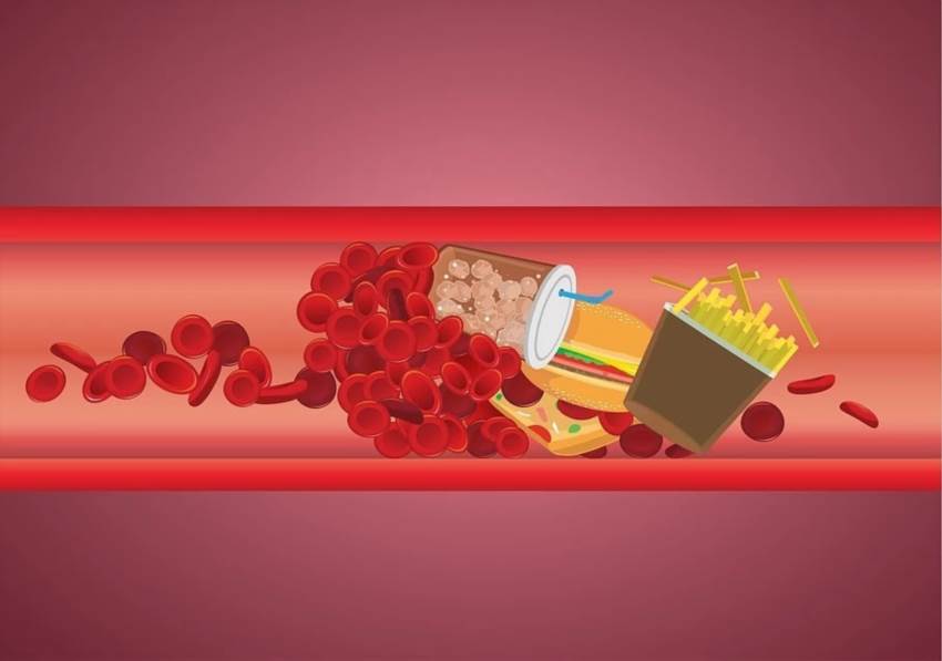 Народні методи зниження холестерину без ліків практичний посібник