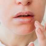 Вальтрекс від герпесу – надійний захист коли це потрібно найбільше